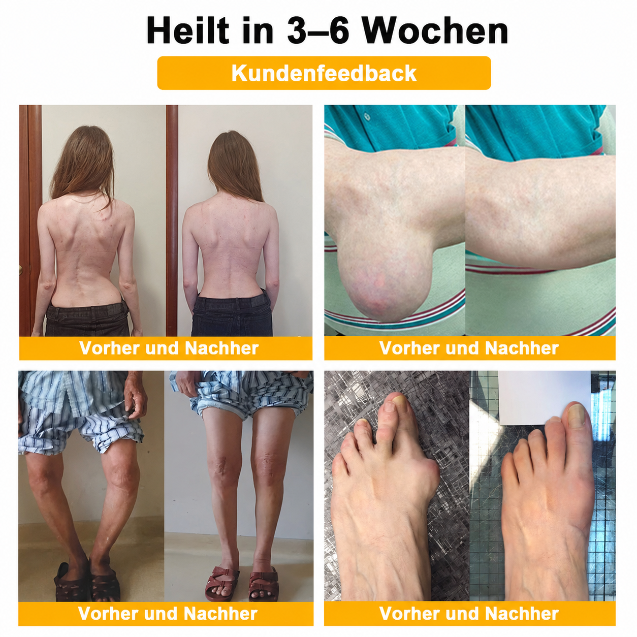 Letzte Chance! Sichere dir dieses Mega-Schnäppchen mit 90 % Rabatt! 🔥 180 Tage Geld-zurück-Garantie! Kostenloser Versand! Natravor®