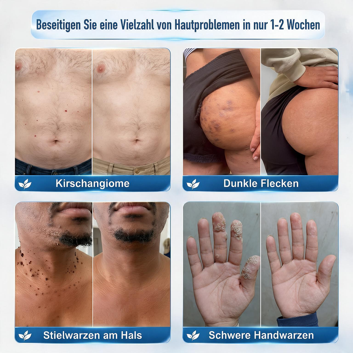 Natravor® 7-Tage Hauterneuerungs- & Reparaturcreme — Beruhigt Juckreiz und unterstützt die Hautregeneration (Sanfte, schmerzfreie Hautpflegeformel) 💎