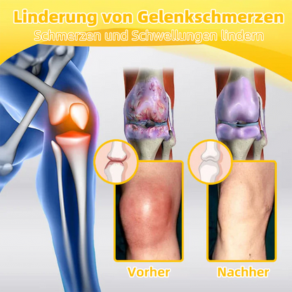🐝Natravor® 𝑩𝒊𝒆𝒏𝒆𝒏𝒈𝒊𝒇𝒕 𝑺𝒄𝒉𝒎𝒆𝒓𝒛𝒍𝒊𝒏𝒅𝒆𝒓𝒖𝒏𝒈𝒔-𝑲𝒏𝒐𝒄𝒉𝒆𝒏𝒉𝒆𝒊𝒍𝒖𝒏𝒈𝒔-𝑪𝒓𝒆𝒎𝒆 (Speziell für ältere Erwachsene und Empfehlung der DGOU) ✨Sonderangebot für begrenzte Zeit✨
