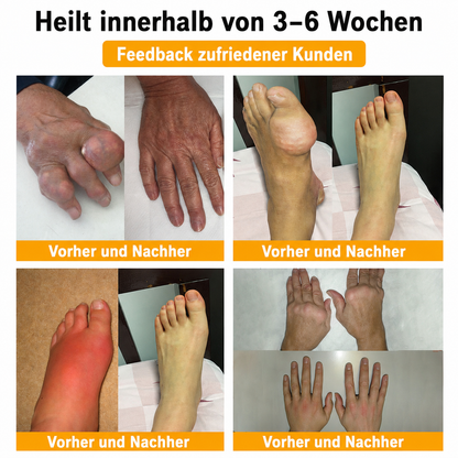 Letzte Chance! Sichere dir dieses Mega-Schnäppchen mit 90 % Rabatt! 🔥 180 Tage Geld-zurück-Garantie! Kostenloser Versand! Natravor®
