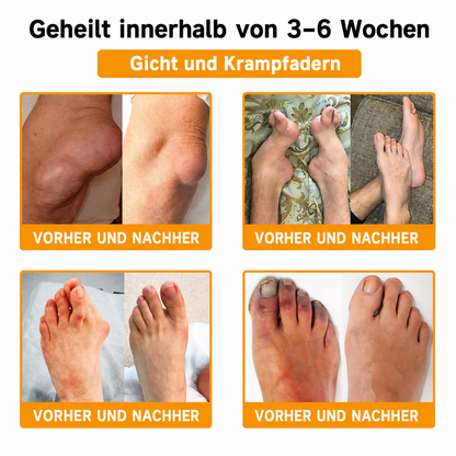 Letzte Chance! Sichere dir dieses Mega-Schnäppchen mit 90 % Rabatt! 🔥 180 Tage Geld-zurück-Garantie! Kostenloser Versand! Natravor®