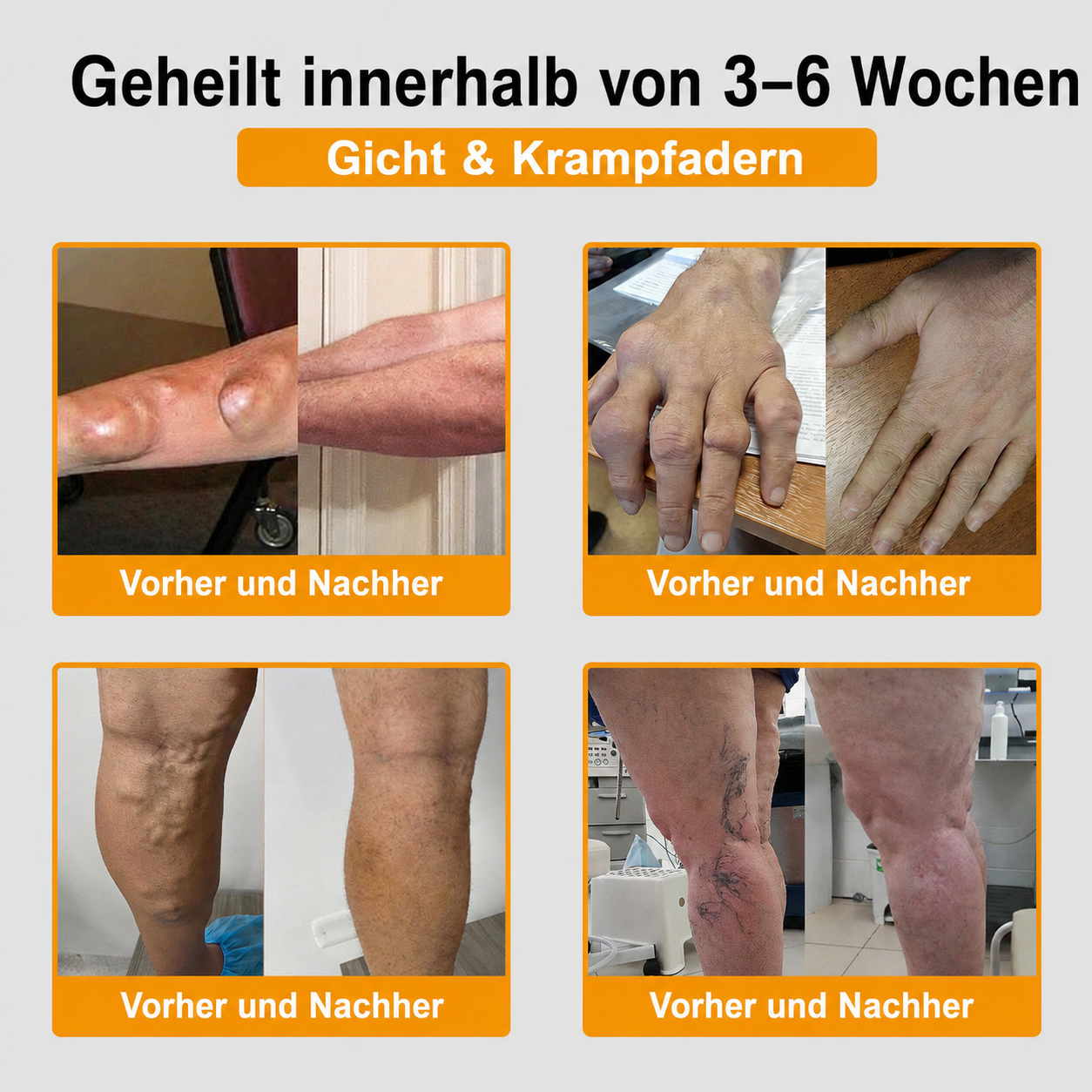 Letzte Chance! Sichere dir dieses Mega-Schnäppchen mit 90 % Rabatt! 🔥 180 Tage Geld-zurück-Garantie! Kostenloser Versand! Natravor®