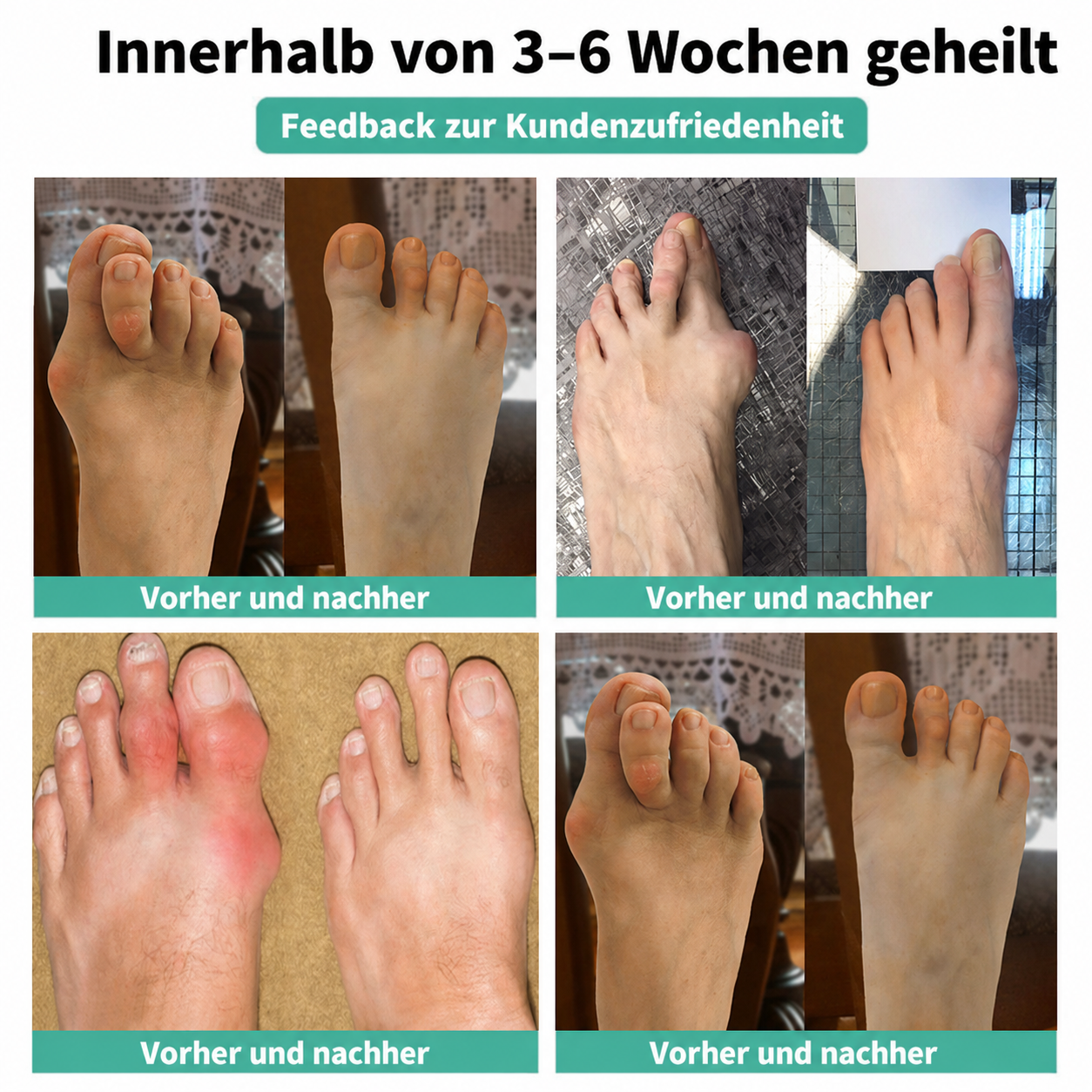 🏅 Natravor® Botanisches Komfort-Pflaster bei Hallux valgus 👠 Flexible Fußpflege + pflanzlich inspirierte Komfortformel